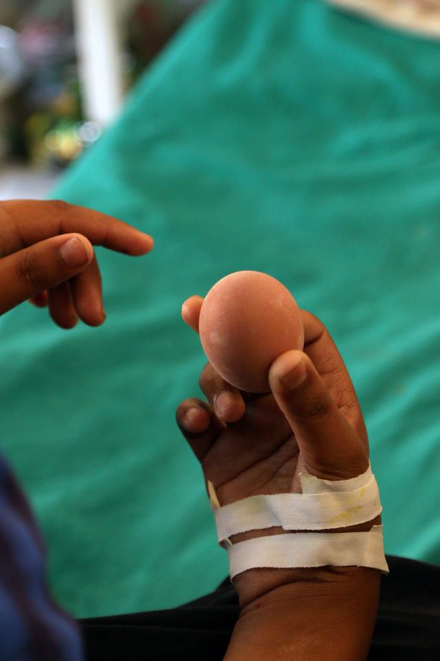 AN-EGG-A-DAY-Spreading-Smiles-Nepal-3